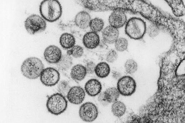 hantavirus-93a0017446e92ecdcc47203888bf0fff_600x400.jpg